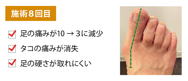 施術8回目
