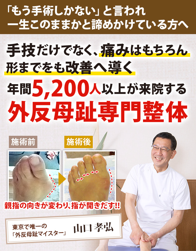 手技だけでなく、痛みはもちろん形までをも改善へ導く!年間5,200人以上が来院する外反母趾専門整体